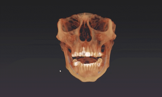 Dexis OP 3D™ LX 15x20 FOV Ceph. Dexis OP 3D™ LX 15x20 FOV Ceph.