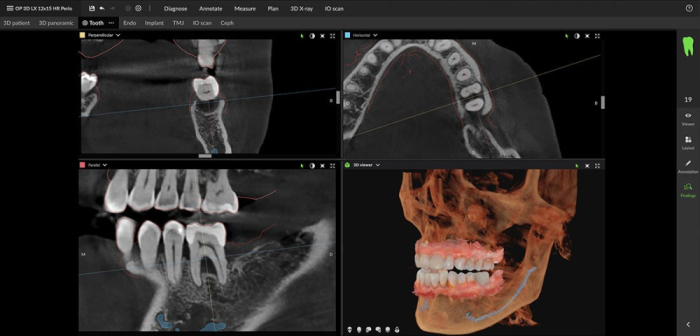 Dexis OP 3D™ LX 15x20 FOV Ceph. Dexis OP 3D™ LX 15x20 FOV Ceph.