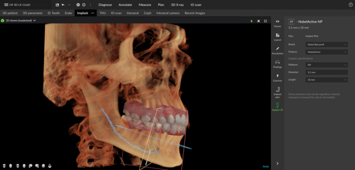 Dexis OP 3D™ LX 15x20 FOV Ceph. Dexis OP 3D™ LX 15x20 FOV Ceph.