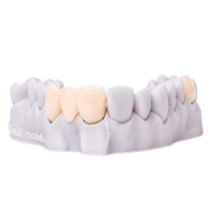 RS VIVO C&B Smile B3 - 500g